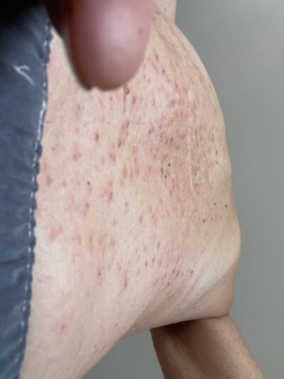 Myrash020324IMG_7950