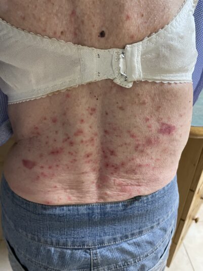 PBrash260224IMG_7930