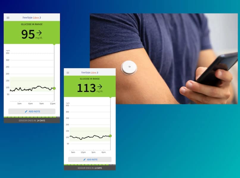 glucose monitoring