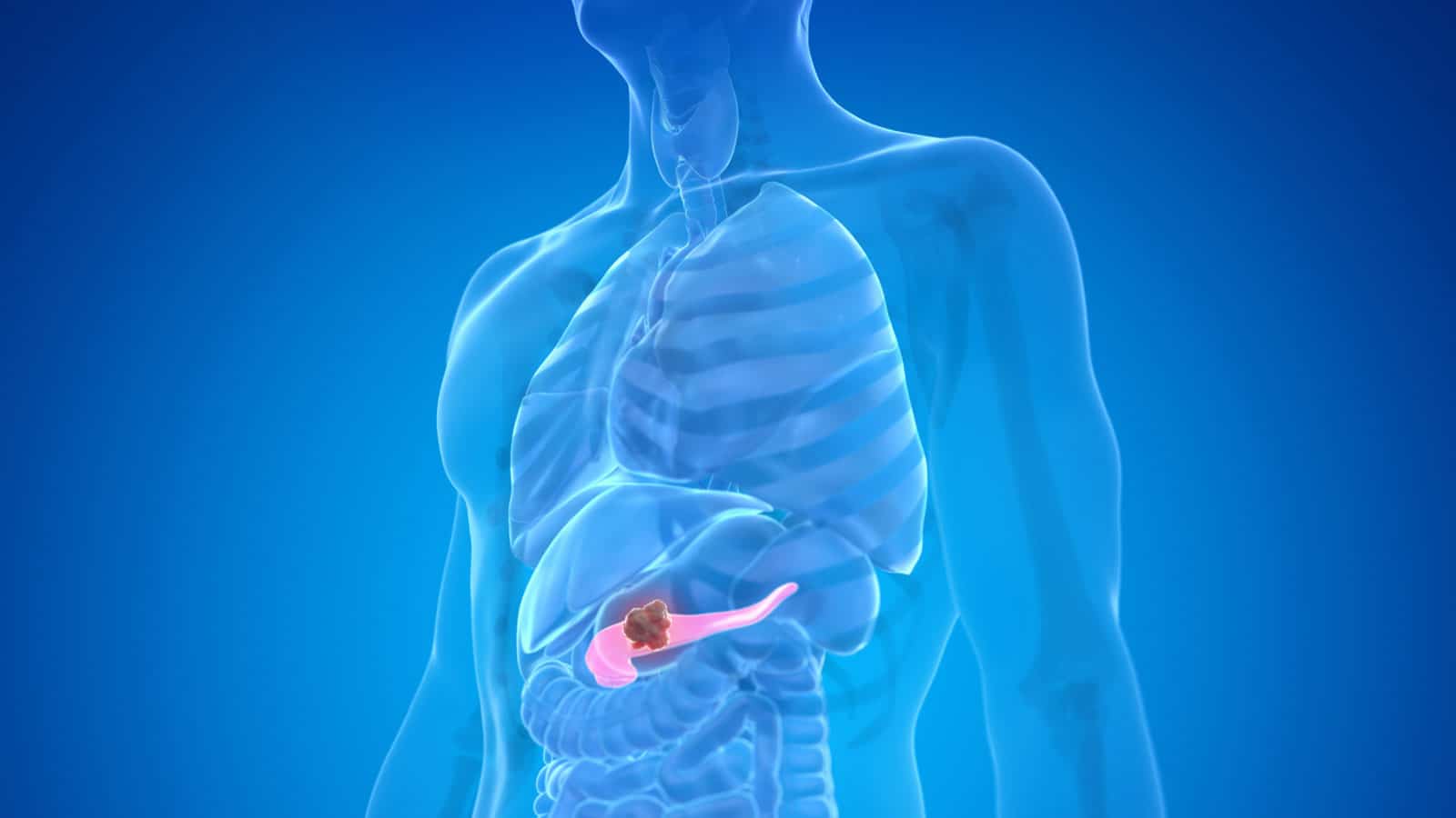 stop the 10 deadliest cancers