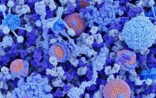 PACVS immune dysregulation