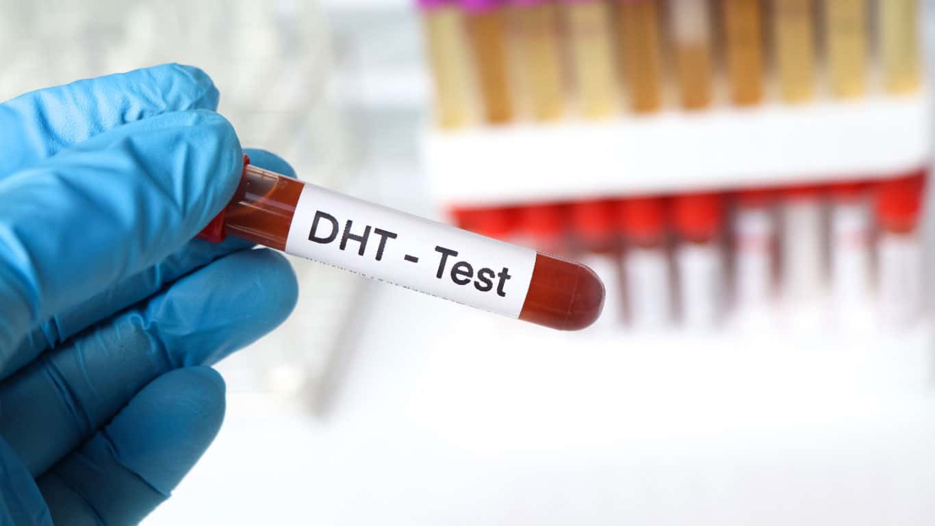 test for hair loss biomarkers