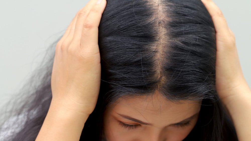 dealing with womens hair loss